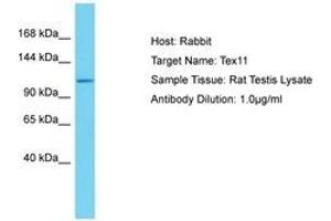 Image no. 1 for anti-Testis Expressed 11 (TEX11) (AA 39-88) antibody (ABIN6750355) (TEX11 antibody  (AA 39-88))