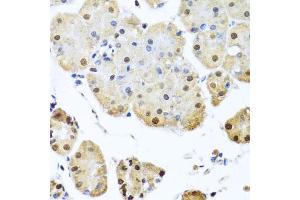Immunohistochemistry (IHC) image for anti-Nuclear Mitotic Apparatus Protein 1 (NUMA1) (AA 1-309) antibody (ABIN1681136)