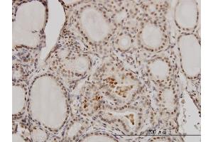 Immunoperoxidase of monoclonal antibody to RCC1 on formalin-fixed paraffin-embedded human thyroid nodular goiter. (RCC1 antibody  (AA 312-421))