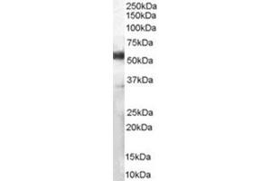 Image no. 2 for anti-CD14 (CD14) (Internal Region) antibody (ABIN374645) (CD14 antibody  (Internal Region))