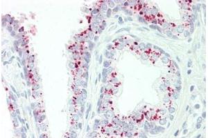Human Prostate: Formalin-Fixed, Paraffin-Embedded (FFPE) (GAA antibody  (AA 174-203))