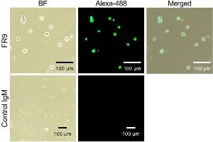 Immunocytochemical analysis of FR9 epitopes expressed on cell surface Immunocytochemical analysis was performed using Burkitt's lymphoma cells (Raji cells). (ST6GAL1 antibody)
