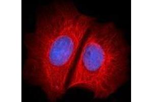 Immunofluorescence (IF) image for anti-Keratin 1 (KRT1) antibody (Alexa Fluor 647) (ABIN2657196) (Cytokeratin 1 antibody  (Alexa Fluor 647))