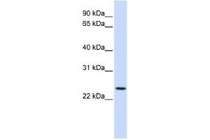 PRRG3 antibody used at 1 ug/ml to detect target protein. (PRRG3 antibody  (N-Term))