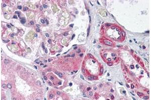 Human Kidney (formalin-fixed, paraffin-embedded) stained with GIPC1 antibody ABIN214108 at 5 ug/ml followed by biotinylated goat anti-rabbit IgG secondary antibody ABIN481713, alkaline phosphatase-streptavidin and chromogen. (GIPC1 antibody  (AA 40-89))