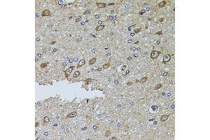 Immunohistochemistry of paraffin-embedded rat brain using MTIF3 antibody. (MTIF3 antibody)