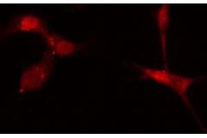 ABIN6272619 staining A549 cells by IF/ICC. (KALRN antibody  (C-Term))