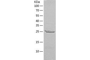 Western Blotting (WB) image for Excision Repair Cross Complementing Polypeptide-1 (ERCC1) (AA 1-273) protein (His tag) (ABIN7122859) (ERCC1 Protein (AA 1-273) (His tag))