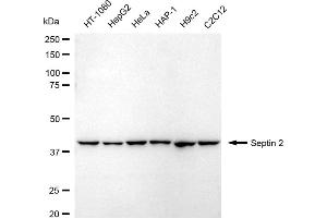 Western blotting analysis using Septin 2 antibody (ABIN7800295). (Recombinant Septin 2 antibody)