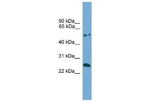 Western Blot showing ETHE1 antibody used at a concentration of 1-2 ug/ml to detect its target protein. (ETHE1 antibody  (Middle Region))