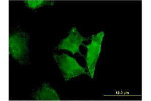 Immunofluorescence of monoclonal antibody to RASSF3 on HeLa cell. (RASSF3 antibody  (AA 29-112))