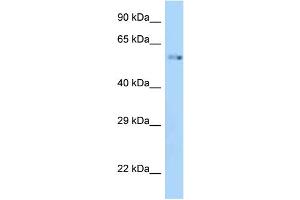 WB Suggested Anti-Zik1 Antibody Titration: 1. (ZIK1 antibody  (C-Term))