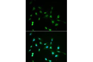 Immunofluorescence analysis of A549 cells using PIWIL4 antibody (ABIN5971612). (PIWIL4 antibody)
