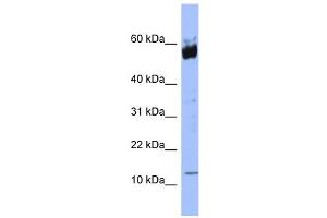 WB Suggested Anti-S100A9 Antibody Titration: 0. (S100A9 antibody  (N-Term))