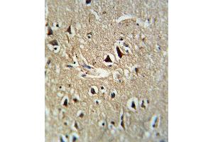 Formalin-fixed and paraffin-embedded human brain tissue reacted with PCSK2 Antibody (Center), which was peroxidase-conjugated to the secondary antibody, followed by DAB staining. (PCSK2 antibody  (AA 318-346))
