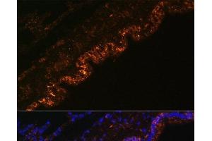 Immunofluorescence analysis of Rat lung cells using SCNN1A Polyclonal Antibody at dilution of 1:100. (SCNN1A antibody)