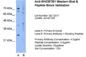 Host:  Rabbit  Target Name:  RHOBTB1  Sample Type:  Jurkat  Lane A:  Primary Antibody  Lane B:  Primary Antibody + Blocking Peptide  Primary Antibody Concentration:  4. (RHOBTB1 antibody  (Middle Region))