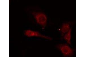 ABIN6275890 staining  COLO205 cells by IF/ICC. (RRM2B antibody  (N-Term))
