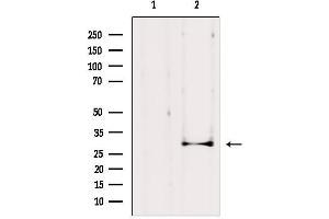 Western blot analysis of extracts from HepG2, using AQP1 Antibody. (Aquaporin 1 antibody  (Internal Region))
