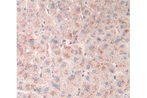 Used in DAB staining on fromalin fixed paraffin- embedded liver tissue (DMPK antibody  (AA 1-201))