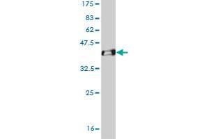 Western Blot detection against Immunogen (37. (OTX1 antibody  (AA 10-116))