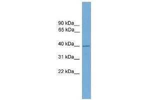 FBXO31 antibody used at 0. (FBXO31 antibody  (Middle Region))