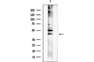 anti-Deoxyhypusine Synthase (DHPS) (Internal Region) antibody