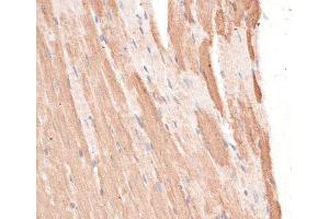 Immunohistochemistry of paraffin-embedded Mouse heart using KIF1C Polyclonal Antibody at dilution of 1:100 (40x lens). (KIF1C antibody)