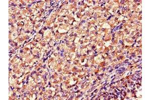 Immunohistochemistry of paraffin-embedded human ovarian tissue using ABIN7160797 at dilution of 1:100 (DDAH2 antibody  (AA 1-285))