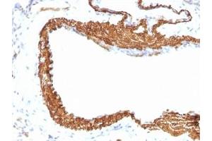 Immunohistochemistry (Formalin-fixed Paraffin-embedded Sections) (IHC (fp)) image for anti-Actin, alpha 2, Smooth Muscle, Aorta (ACTA2) (N-Term) antibody (ABIN3024120)