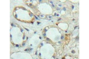 Used in DAB staining on fromalin fixed paraffin-embedded kidney tissue (Ephrin A5 antibody  (AA 21-203))
