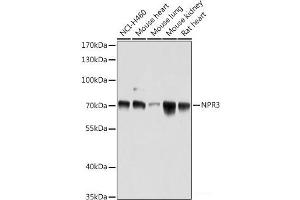 Western blot analysis of extracts of various cell lines using NPR3 Polyclonal Antibody at dilution of 1:1000. (NPR3 antibody)