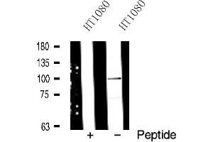 Western blot analysis of ADAM 17 expression in HT1080 whole cell lysates. (ADAM17 antibody  (C-Term))
