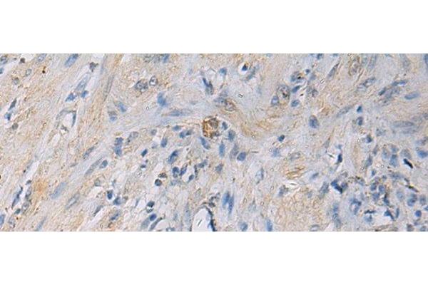 HSDL2 antibody