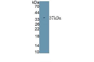 Detection of Recombinant ALPL, Rat using Polyclonal Antibody to Alkaline Phosphatase, Tissue-nonspecific (ALPL) (ALPL antibody)