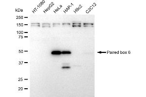 Western blotting analysis using Paired box 6 antibody (ABIN7799725).