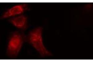 ABIN6277446 staining  Hela cells by IF/ICC.