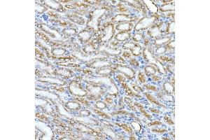 Immunohistochemistry of paraffin-embedded mouse kidney using Syntaxin 16 Rabbit mAb (ABIN7270681) at dilution of 1:50 (40x lens). (Syntaxin 16 antibody)