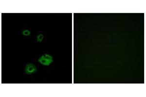 Immunofluorescence analysis of A549 cells, using NPY2R antibody. (NPY2R antibody  (N-Term))