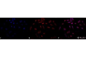 Immunocytochemistry/Immunofluorescence analysis using Mouse Anti-Hsp47 Monoclonal Antibody, Clone 1C4-1A6 . (SERPINH1 antibody  (HRP))