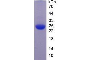SDS-PAGE of Protein Standard from the Kit  (Highly purified E. (JAG1 ELISA Kit)