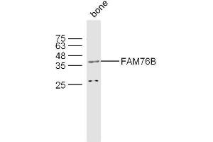 Mouse bone lysates probed with FAM76B Polyclonal Antibody, unconjugated  at 1:300 overnight at 4°C followed by a conjugated secondary antibody at 1:10000 for 60 minutes at 37°C. (FAM76B antibody)