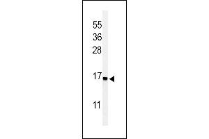 Western blot analysis of RPS25 Antibody (N-term) (ABIN653668 and ABIN2843001) in Jurkat cell line lysates (35 μg/lane).