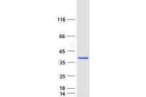 Validation with Western Blot (ETV7 Protein (Myc-DYKDDDDK Tag))