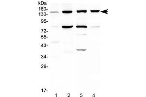 Western blot testing of 1) human HeLa, 2) human HepG2, 3) rat liver and 4) mouse liver lysate with ITGA5 antibody at 0. (ITGA5 antibody)