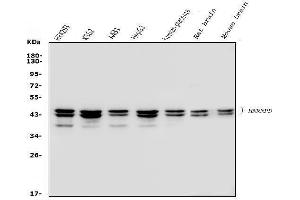 Western blot analysis of hnRNP D/AUF1/HNRNPD using anti-hnRNP D/AUF1/HNRNPD antibody (ABIN7602592).