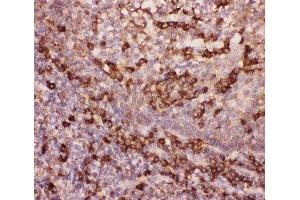 IHC-P: MAC-1 antibody testing of human tonsil tissue (Integrin beta 2 antibody  (AA 17-382))