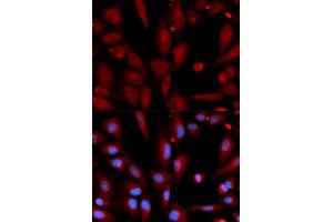 Immunofluorescence analysis of U2OS cells using WIF1 antibody (ABIN5973119).