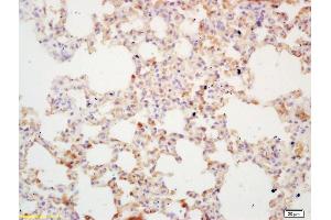 Formalin-fixed and paraffin embedded mouse lung labeled with Rabbit Anti DcR1 Polyclonal Antibody, Unconjugated  at 1:200 followed by conjugation to the secondary antibody and DAB staining (DcR1 antibody  (AA 51-150))