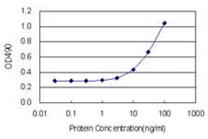 FABP4 (Human) Matched Antibody Pair